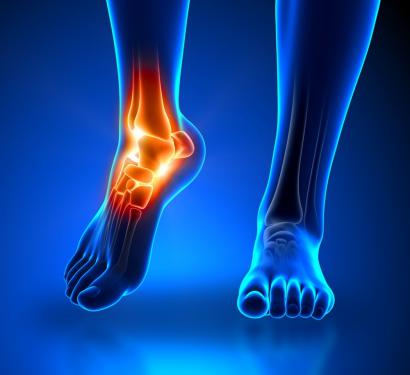 Điều trị hiệu quả và an toàn bênh đau cổ chân