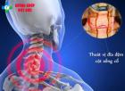 Thoát vị đĩa đệm cột sống cổ - Tìm hiểu nguyên nhân, triệu chứng và cách điều trị